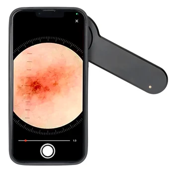 IBOOLO DE-3100 Skanner uuringud pigmenteerunud naha kahjustused, mis on varustatud videokaamera koos suurendusklaasi optika, dermatoscope