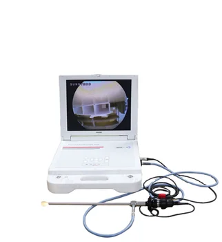 SY-PS045N Kõrge Kvaliteediga Kõik-ühes Hüsteroskoopia Meditsiini Endoscope Kaamera Günekoloogia/Uroloogia/ENT